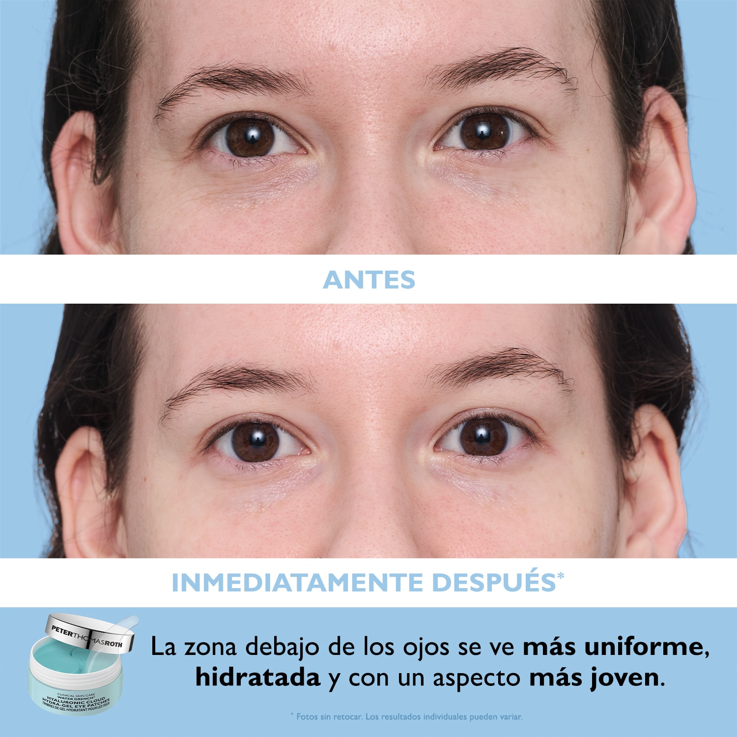FULL-SIZE VITAMIN C & HYALURONIC EYE PATCHES 2-PIECE KIT (SET DE PARCHES PARA OJOS)